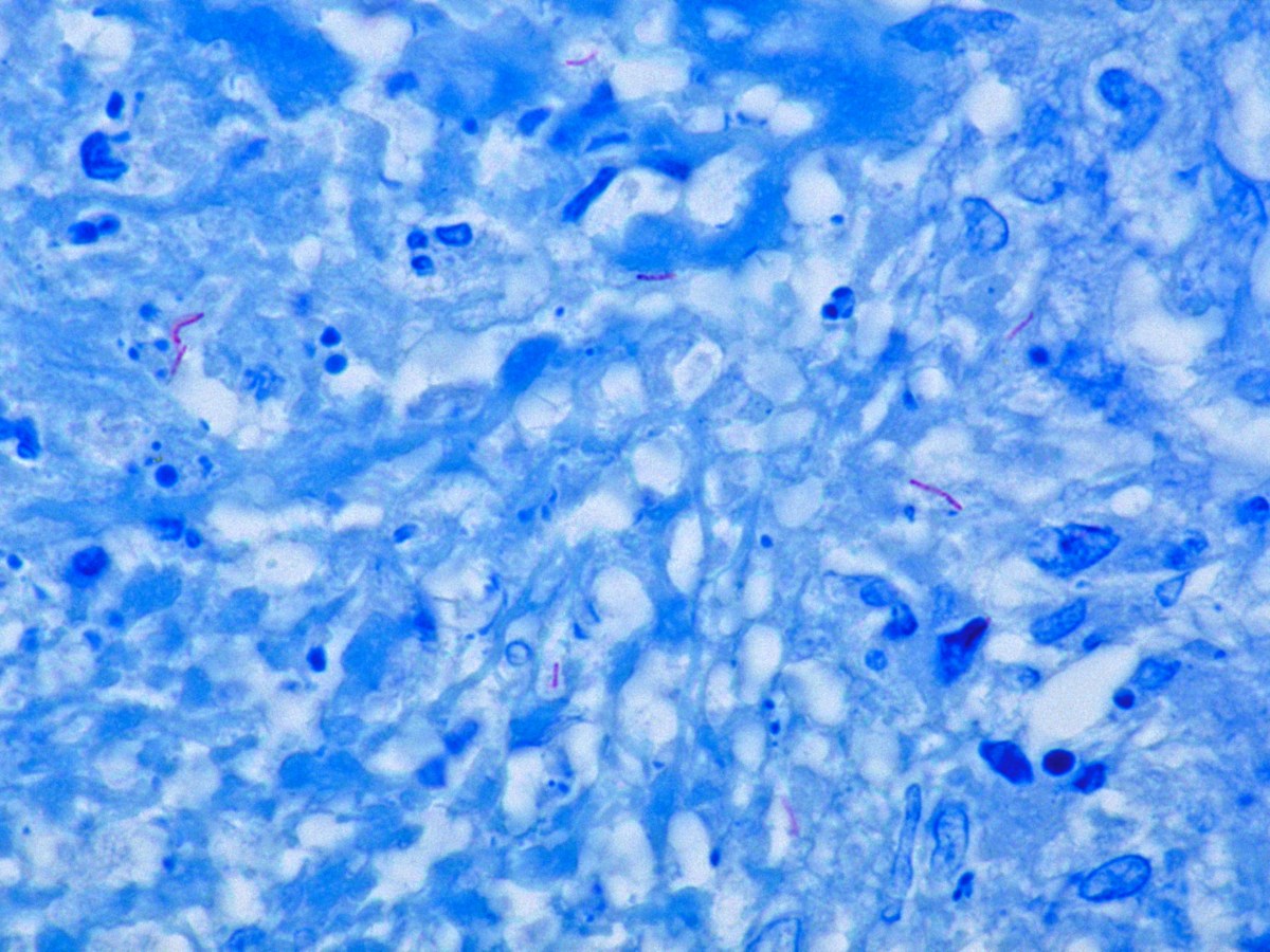 The Interdisciplinary Investments: Collaboration in Global&nbsp;Health