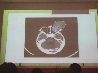 A scan from the oncology ward. Photo credit - Hannah Krystal