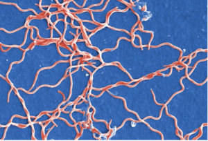 Negative image of a group of borrelia burgdorferi. Source: public-domain-image.com