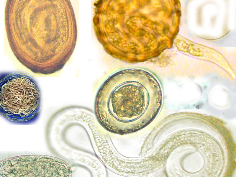 Coinfections: Managing a dynamic network of&nbsp;diseases